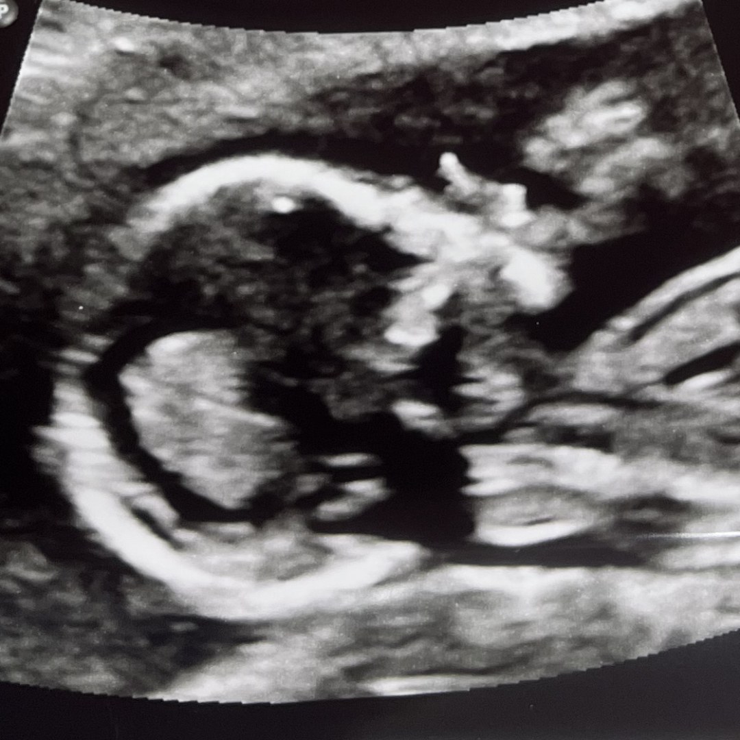 Photo shared by Katie for their Babylist baby registry.