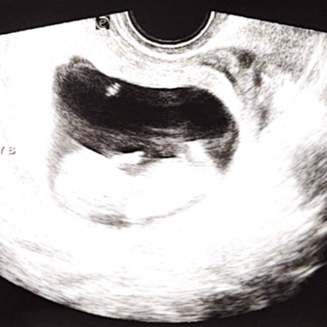 Photo shared by Bridget for their Babylist baby registry.