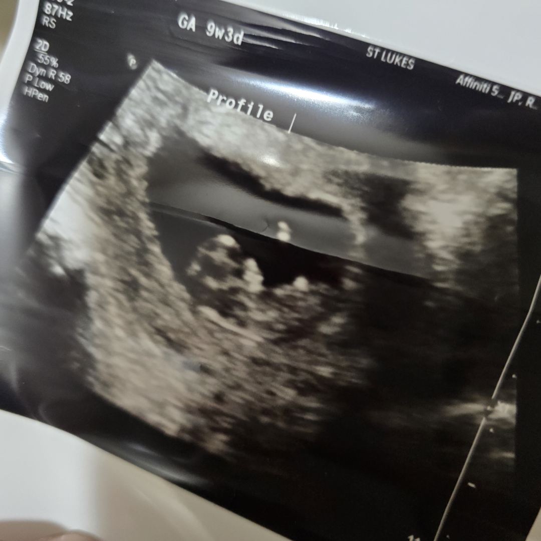 Photo shared by Andrea Petit for their Babylist baby registry.