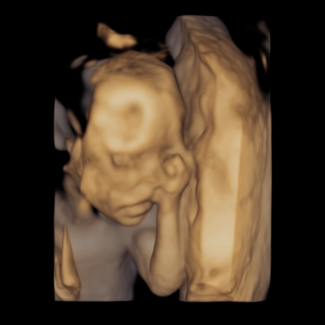 Photo shared by Brianna for their Babylist baby registry.