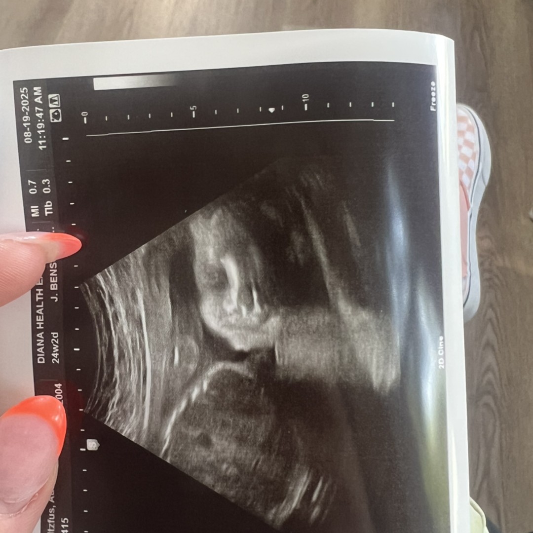 Photo shared by Autumn for their Babylist baby registry.
