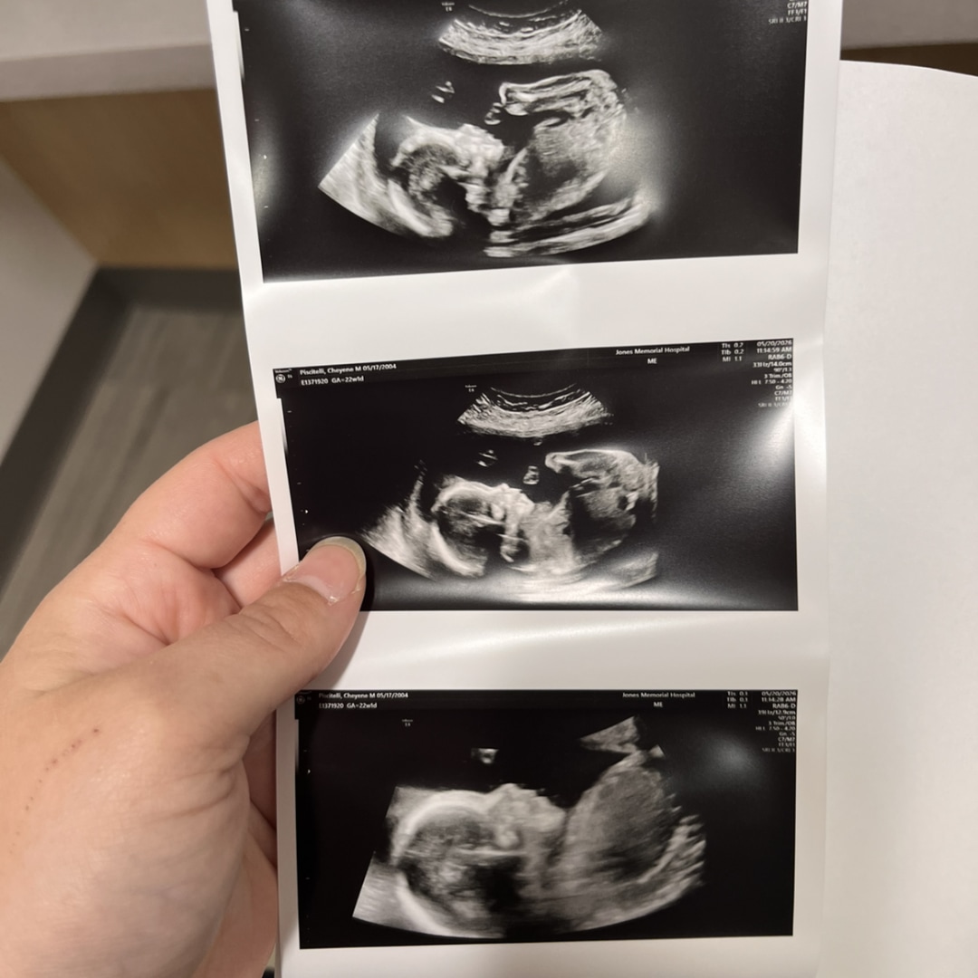 Photo shared by Cheyene for their Babylist baby registry.