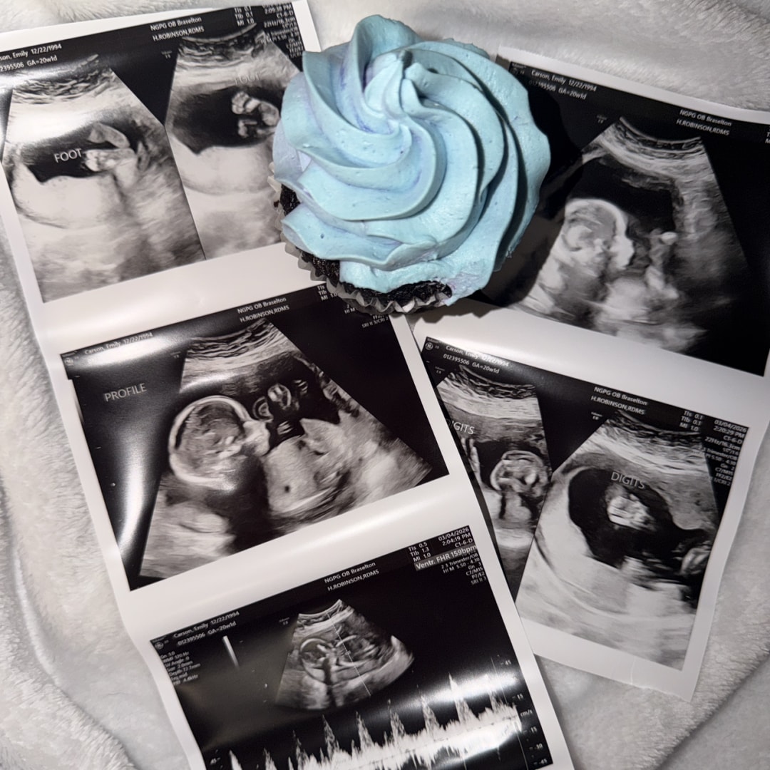 Photo shared by Emily for their Babylist baby registry.