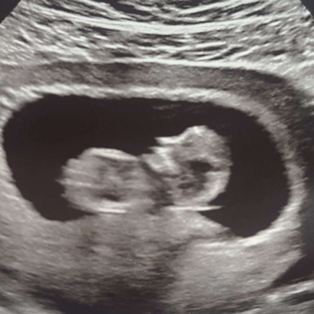 Photo shared by Holly for their Babylist baby registry.