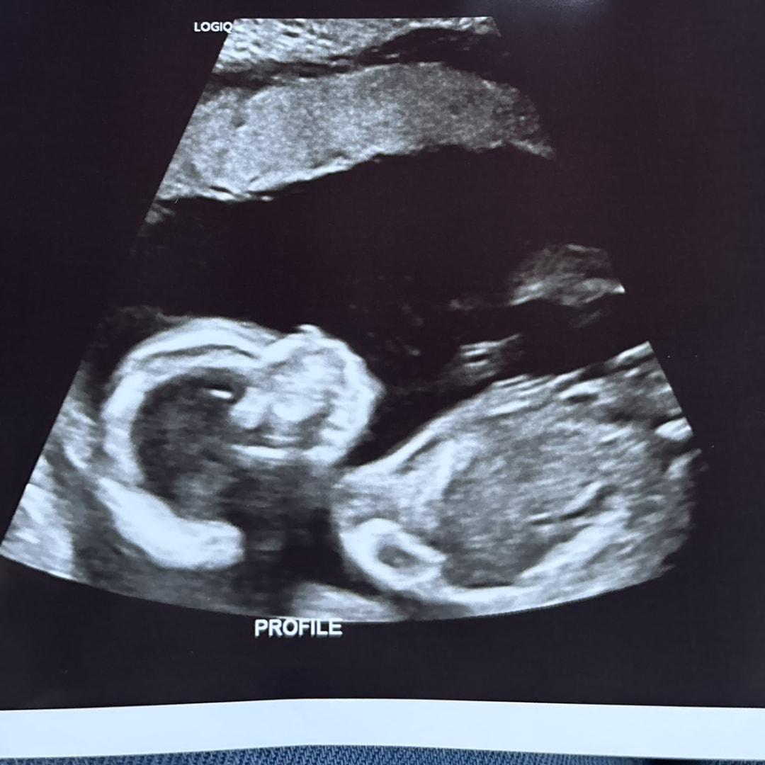 Photo shared by Taylor for their Babylist baby registry.