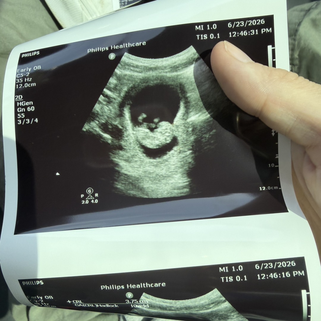 Photo shared by Madison for their Babylist baby registry.