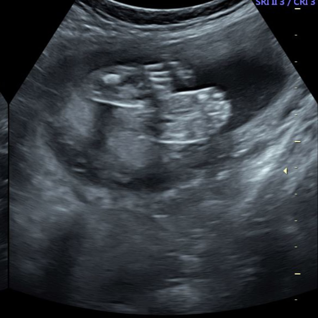 Photo shared by Tai for their Babylist baby registry.