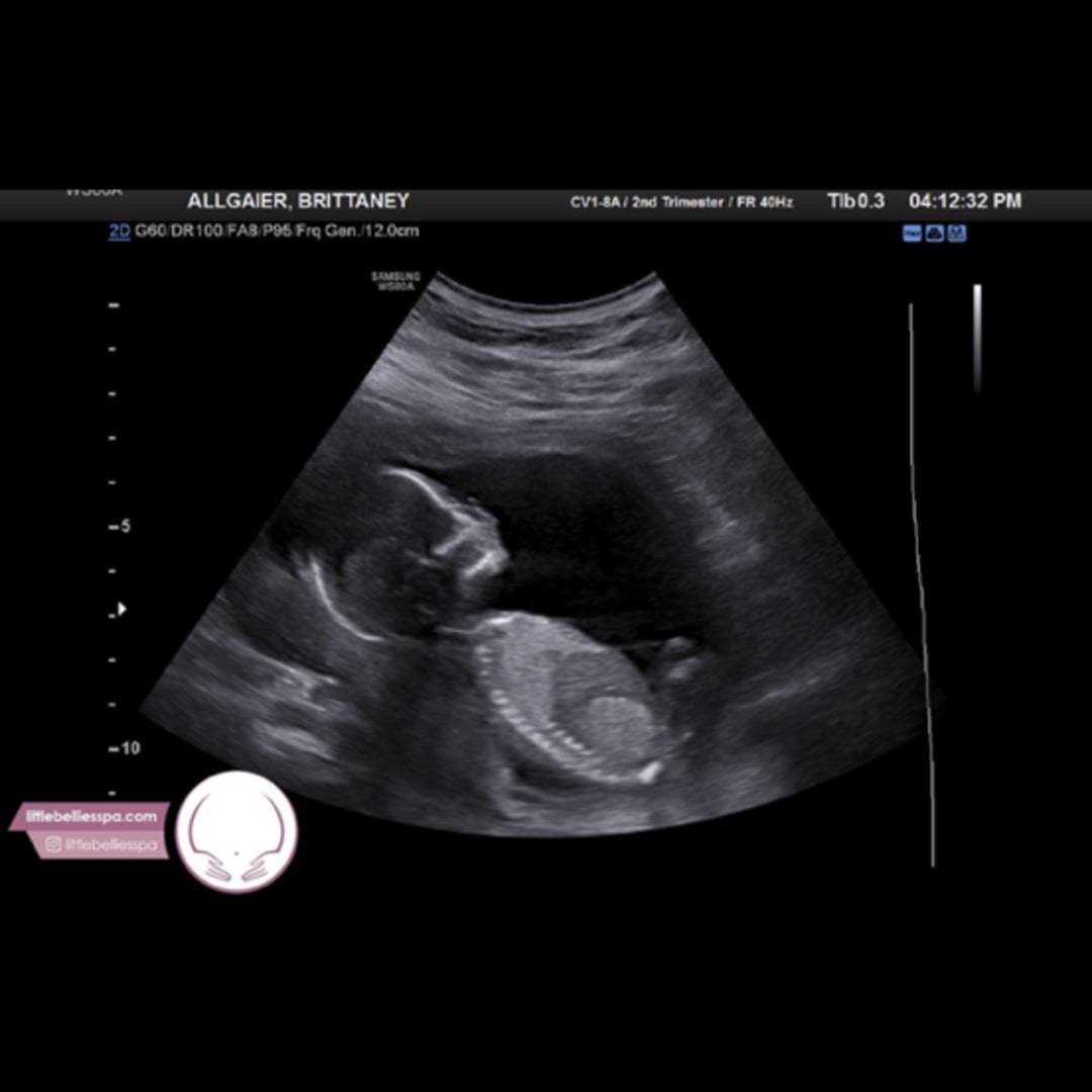 Photo shared by Brittaney for their Babylist baby registry.