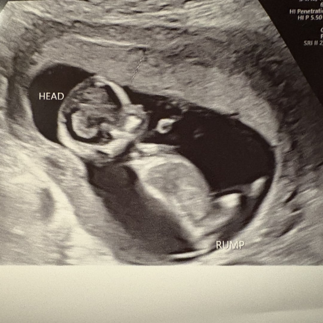 Photo shared by Victoria for their Babylist baby registry.
