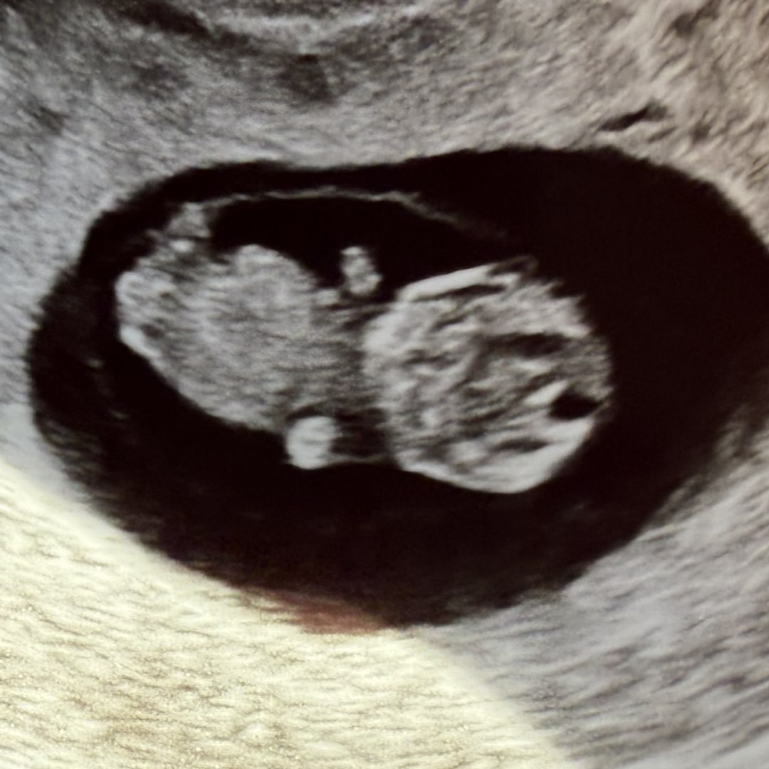 Photo shared by Aracelia for their Babylist baby registry.