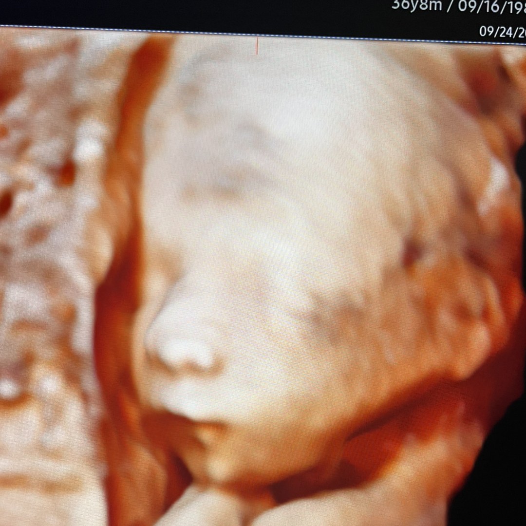 Photo shared by Jocelyn for their Babylist baby registry.