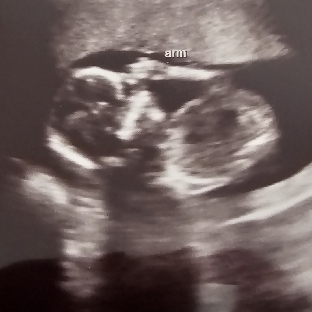 Photo shared by Dominique for their Babylist baby registry.