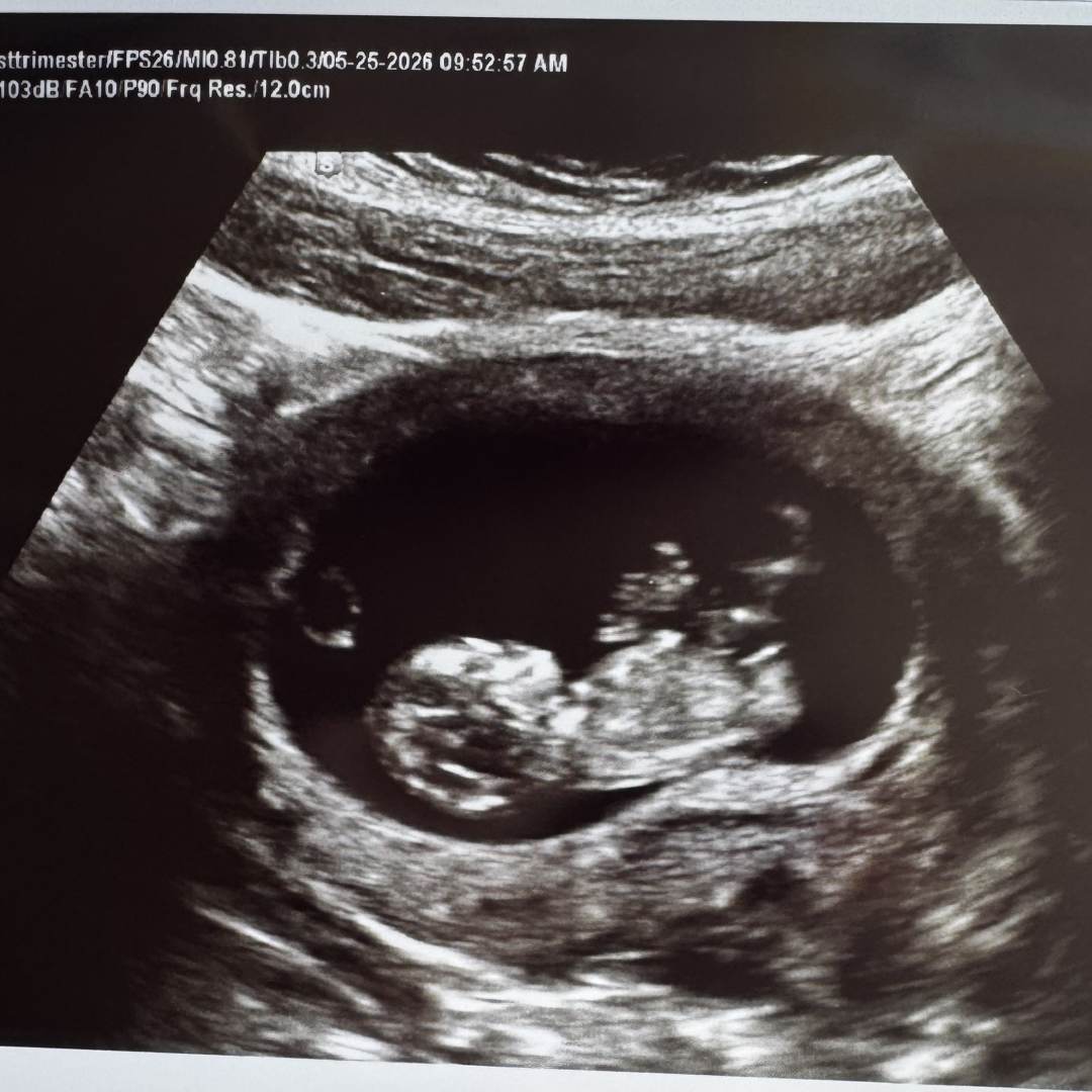 Photo shared by Hailey for their Babylist baby registry.