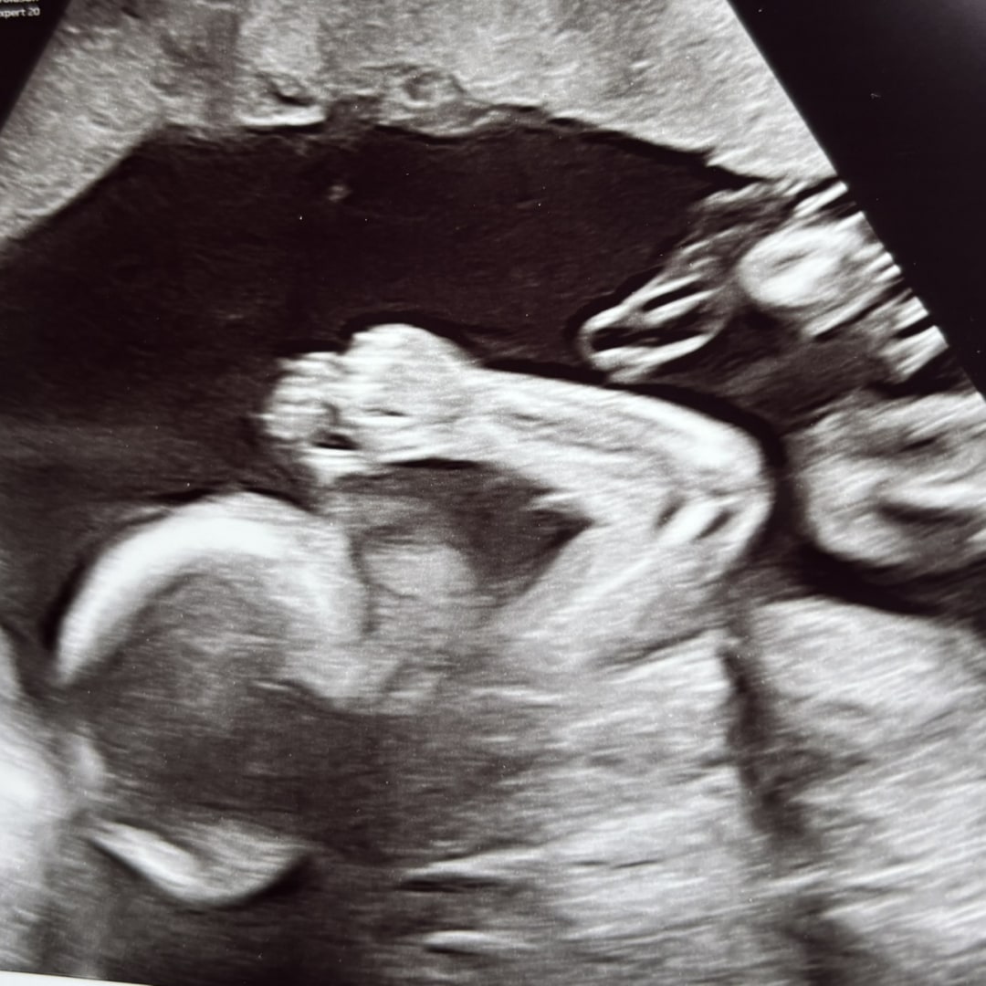 Photo shared by Sarah for their Babylist baby registry.