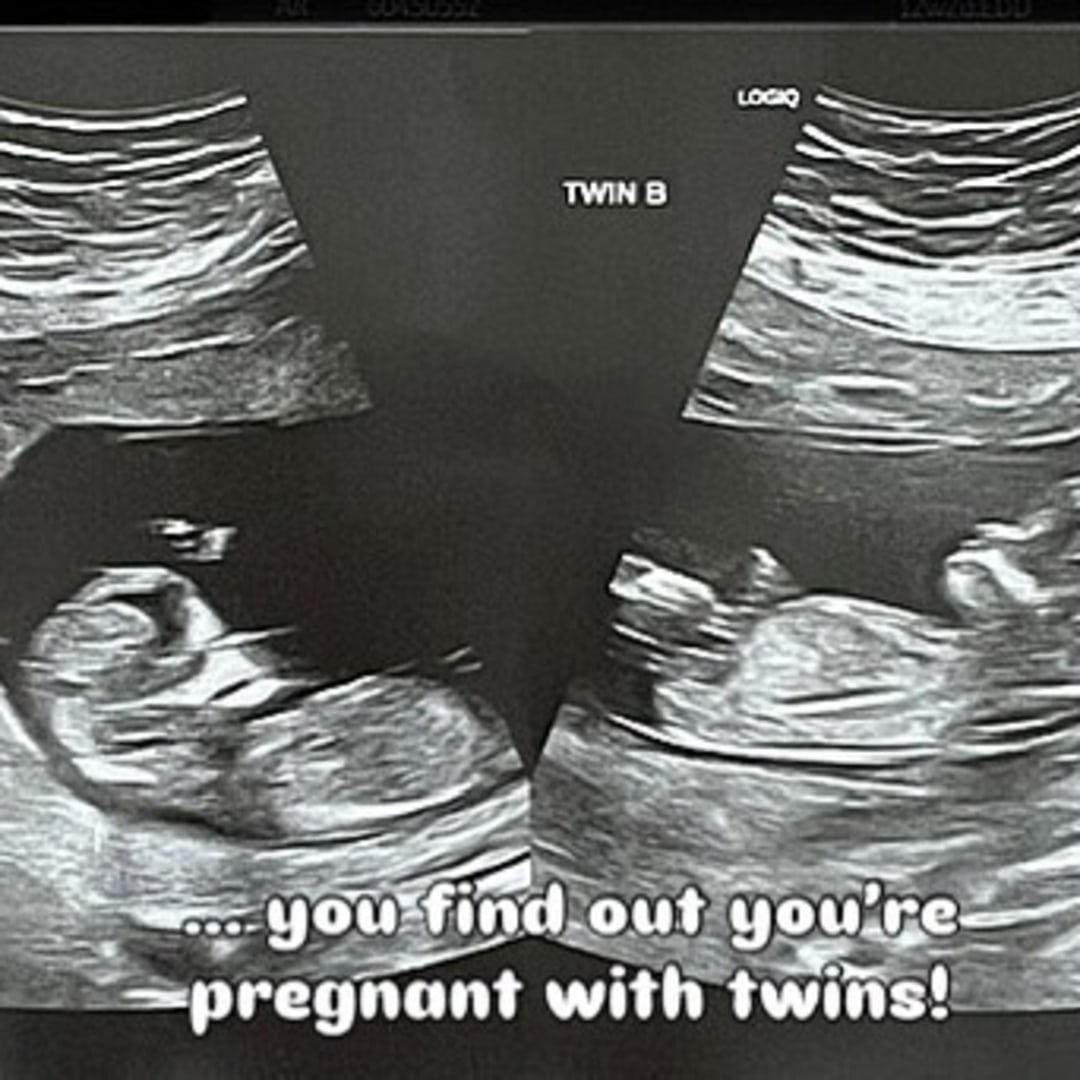 Photo shared by Joselle for their Babylist baby registry.