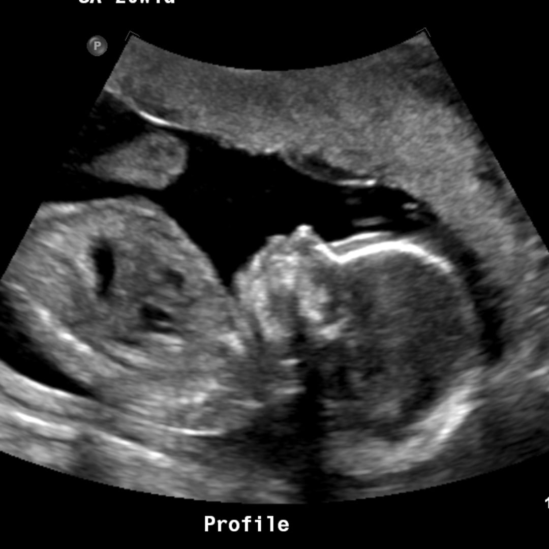 Photo shared by Kinley for their Babylist baby registry.