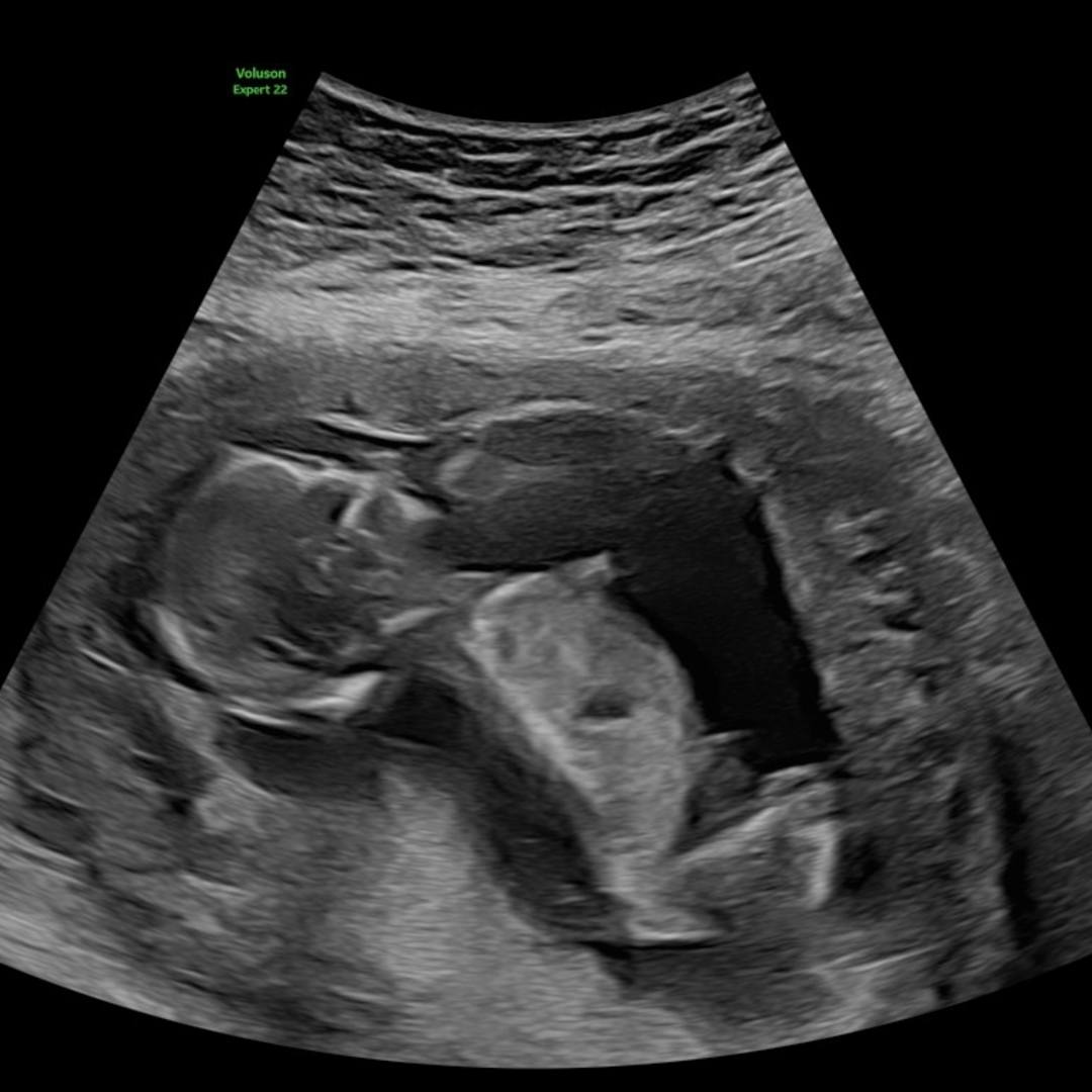 Photo shared by Britni for their Babylist baby registry.