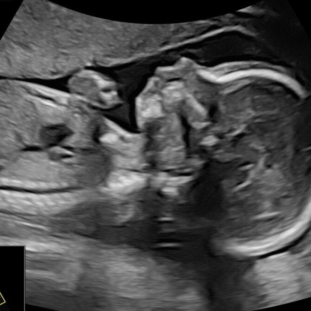 Photo shared by Rockell for their Babylist baby registry.