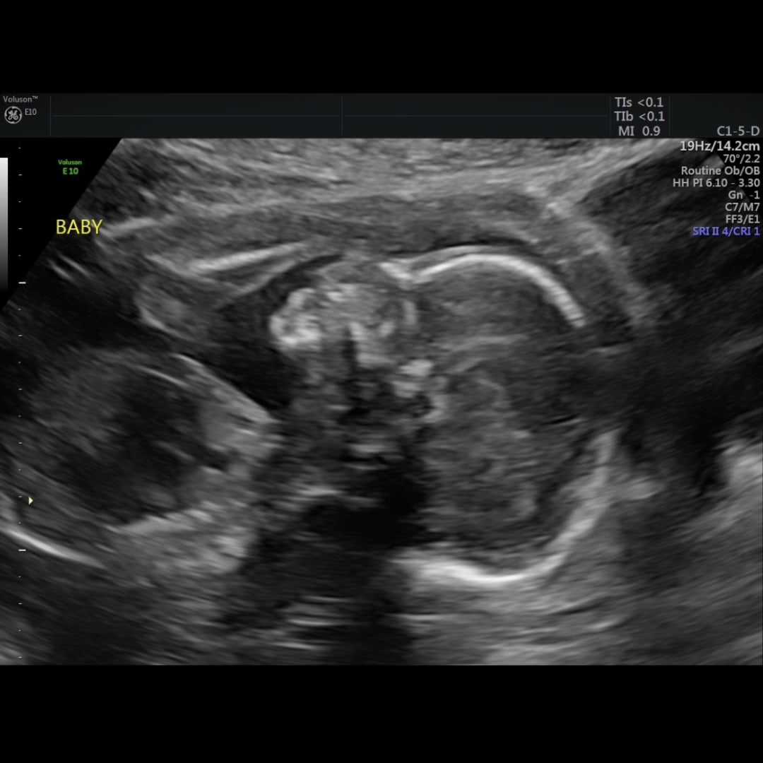 Photo shared by Mackenzie for their Babylist baby registry.