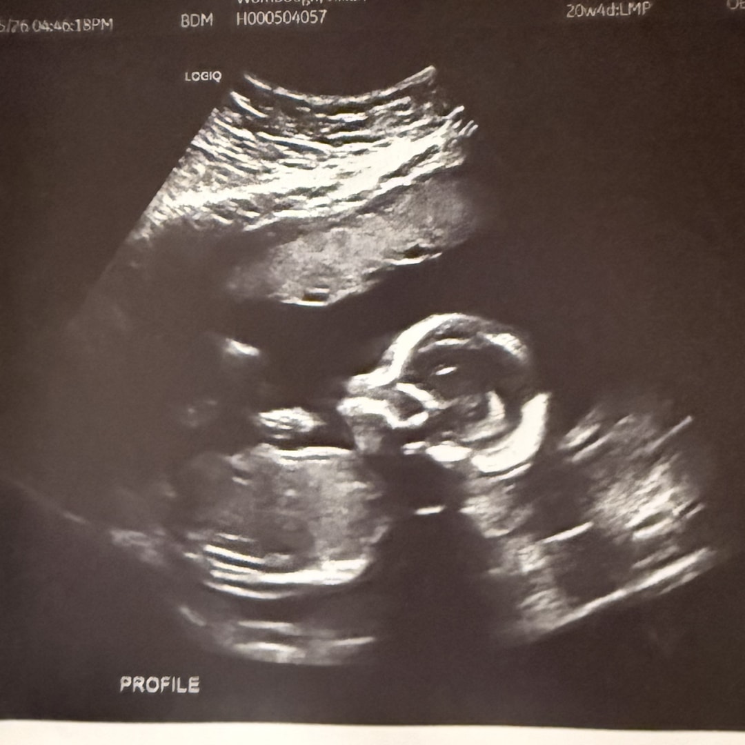 Photo shared by Jillian for their Babylist baby registry.