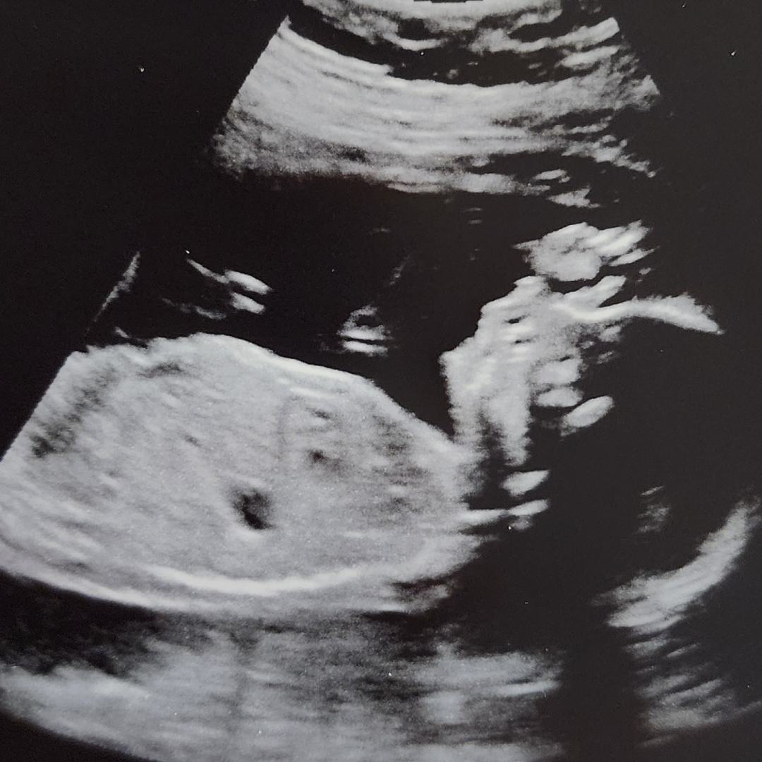 Photo shared by Anna for their Babylist baby registry.