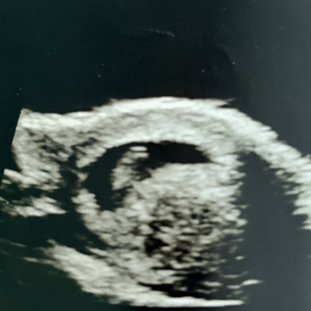 Photo shared by Caitlin for their Babylist baby registry.
