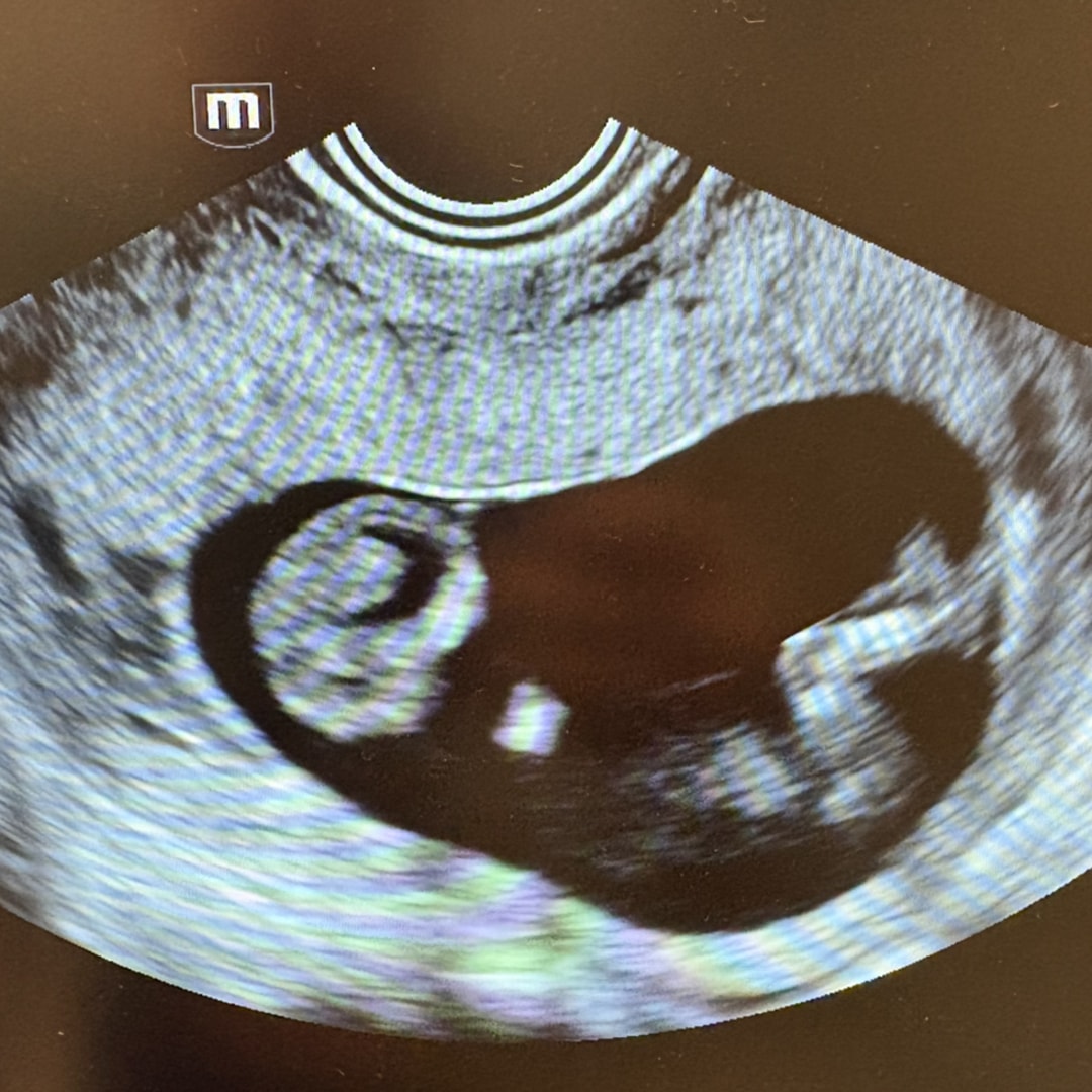 Photo shared by Lindsey for their Babylist baby registry.