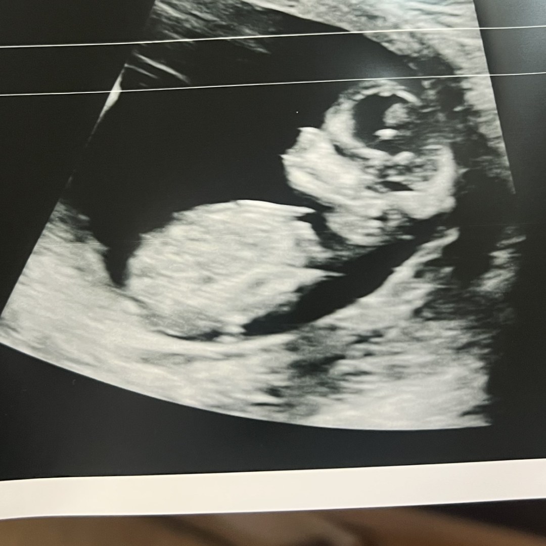 Photo shared by Alyssa for their Babylist baby registry.