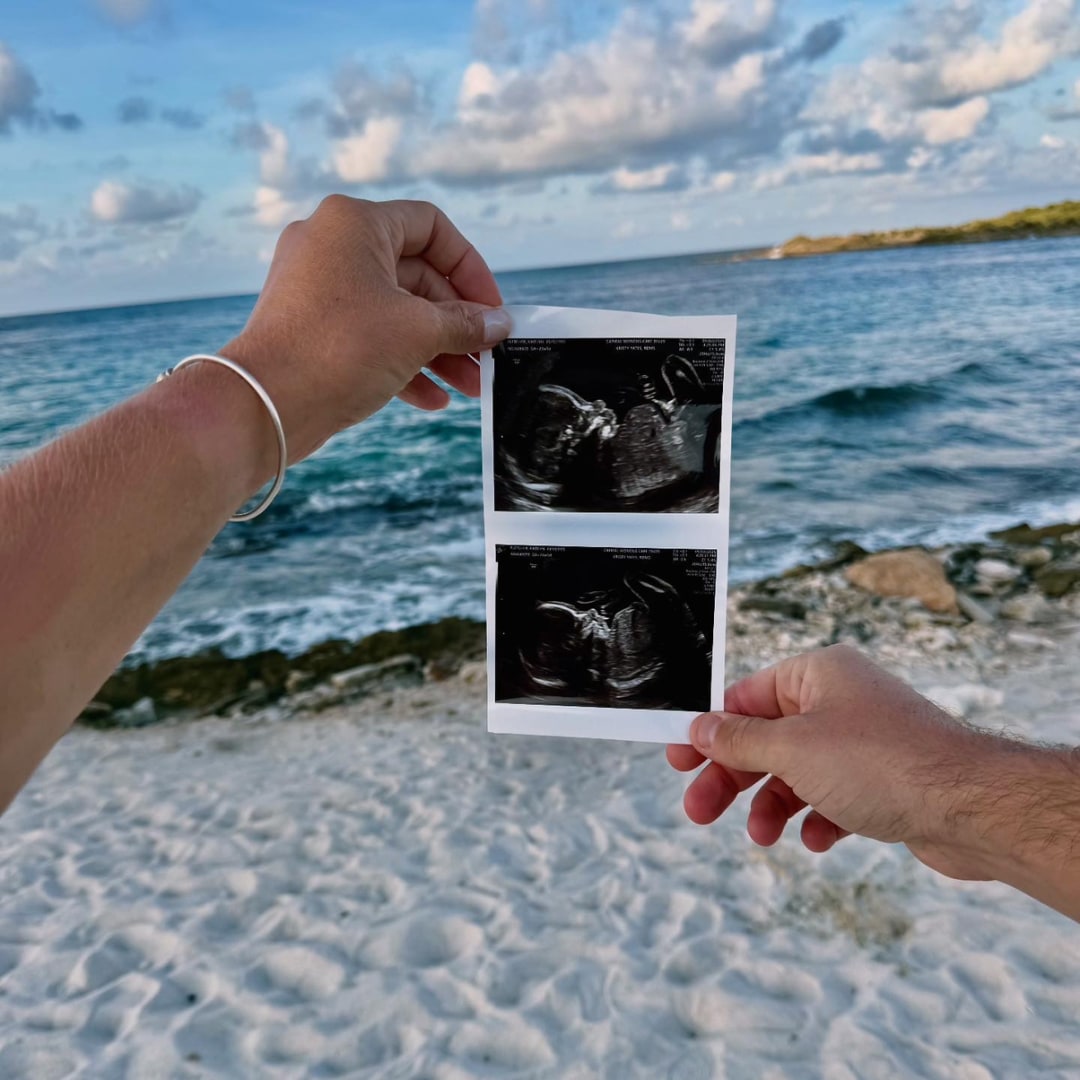 Photo shared by Kate for their Babylist baby registry.