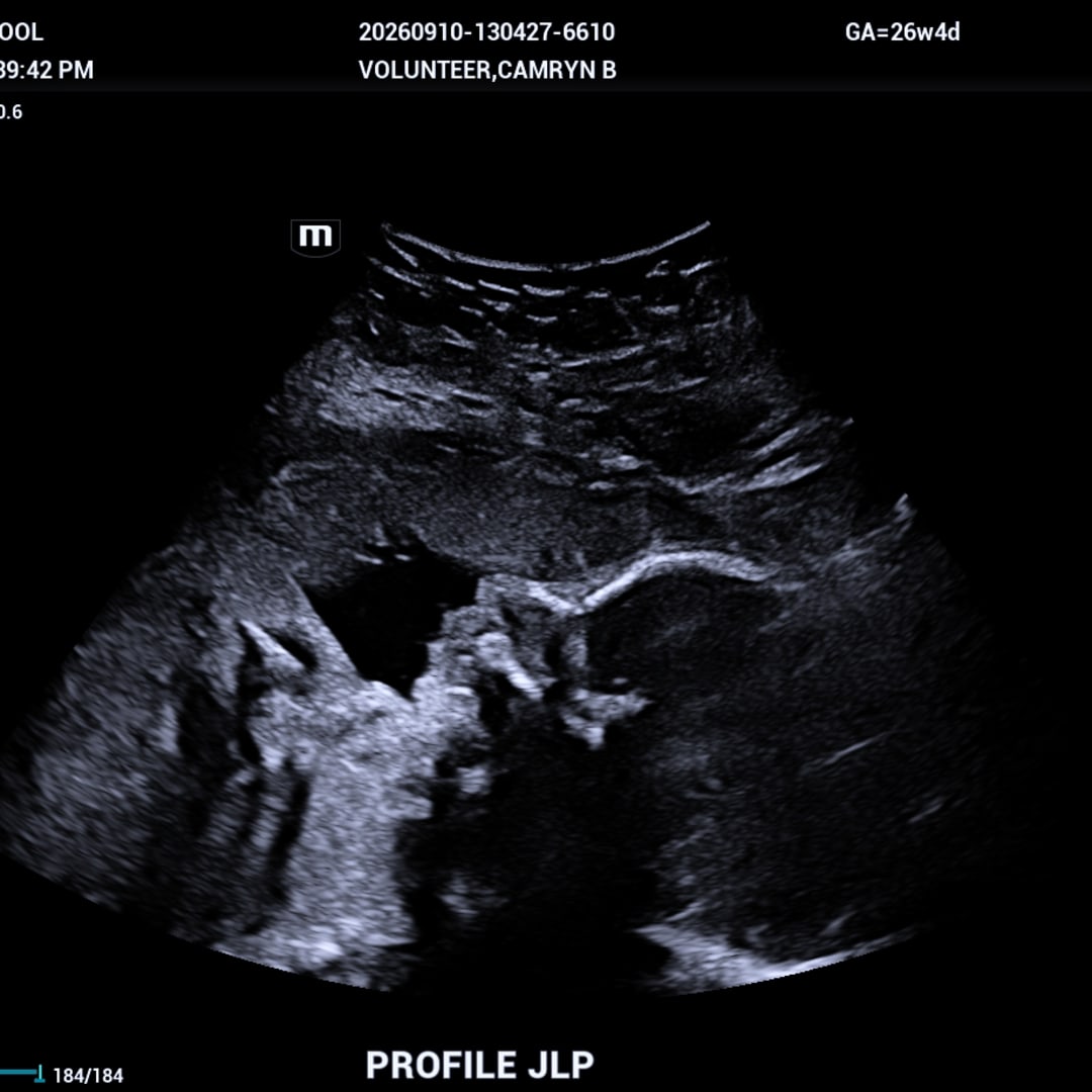 Photo shared by Camryn for their Babylist baby registry.