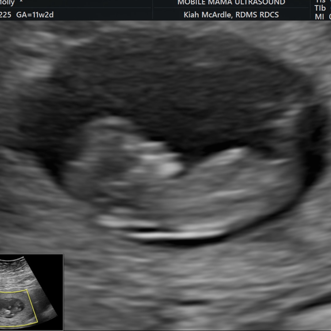 Photo shared by Molly for their Babylist baby registry.