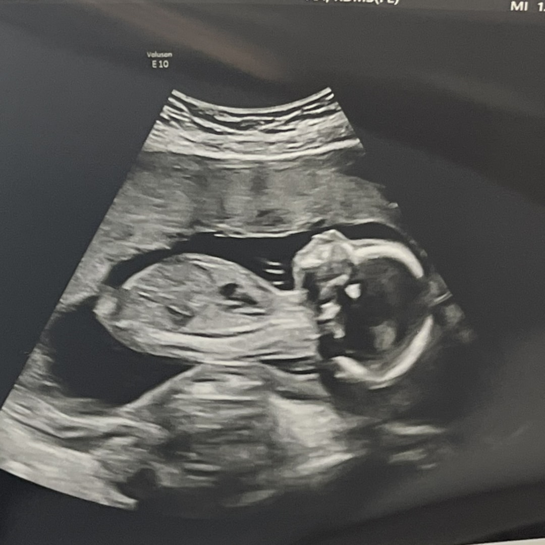 Photo shared by Andrea for their Babylist baby registry.