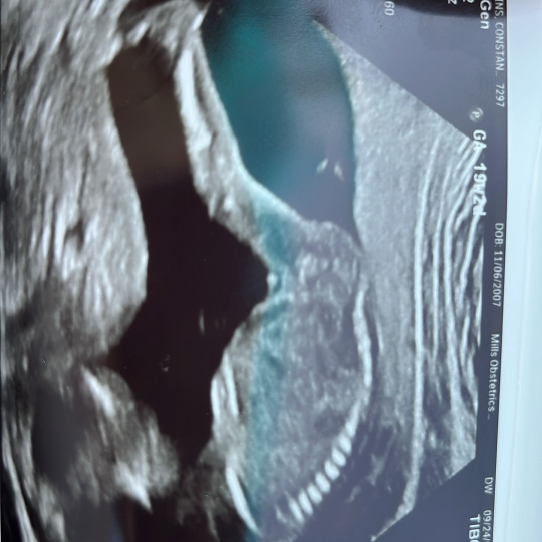 Photo shared by Constance for their Babylist baby registry.