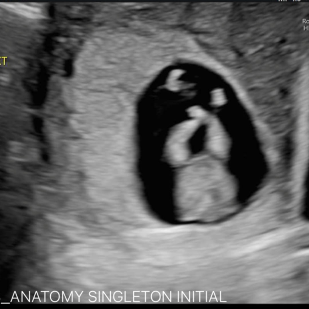 Photo shared by Jennifer for their Babylist baby registry.