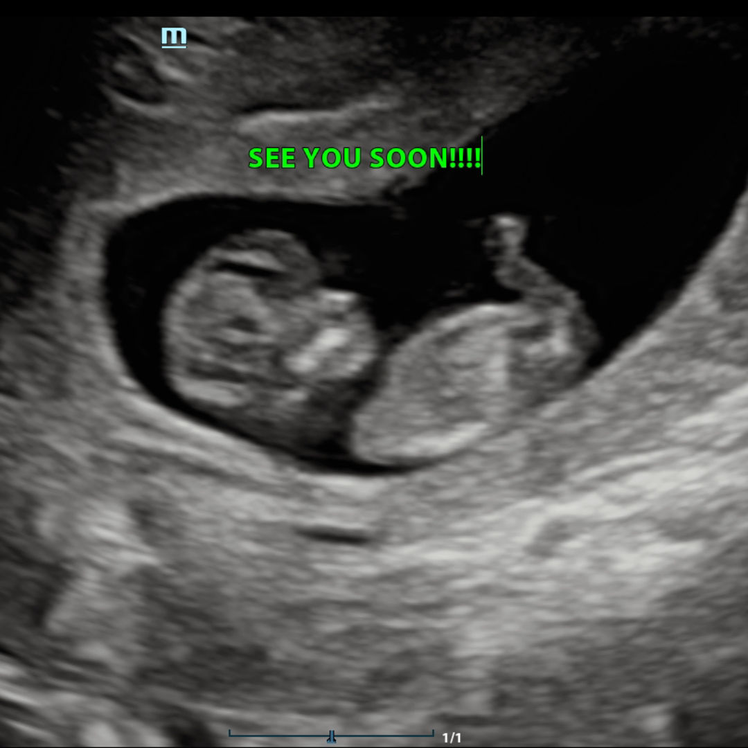 Photo shared by Joeli for their Babylist baby registry.