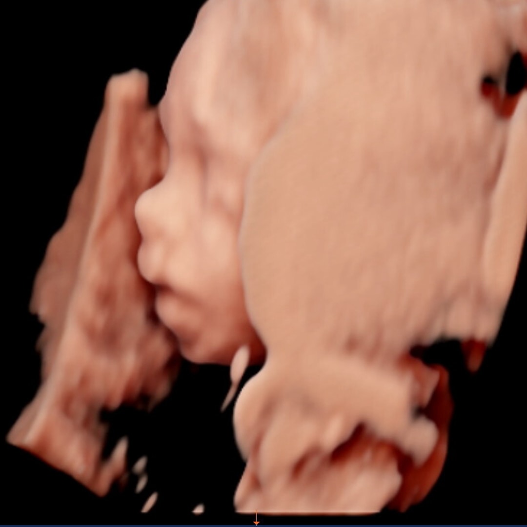 Photo shared by Brianna for their Babylist baby registry.