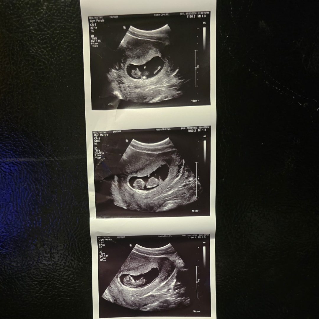 Photo shared by Tristine for their Babylist baby registry.