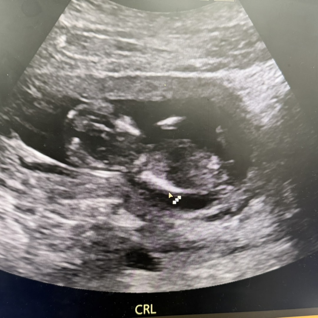 Photo shared by Virgen for their Babylist baby registry.