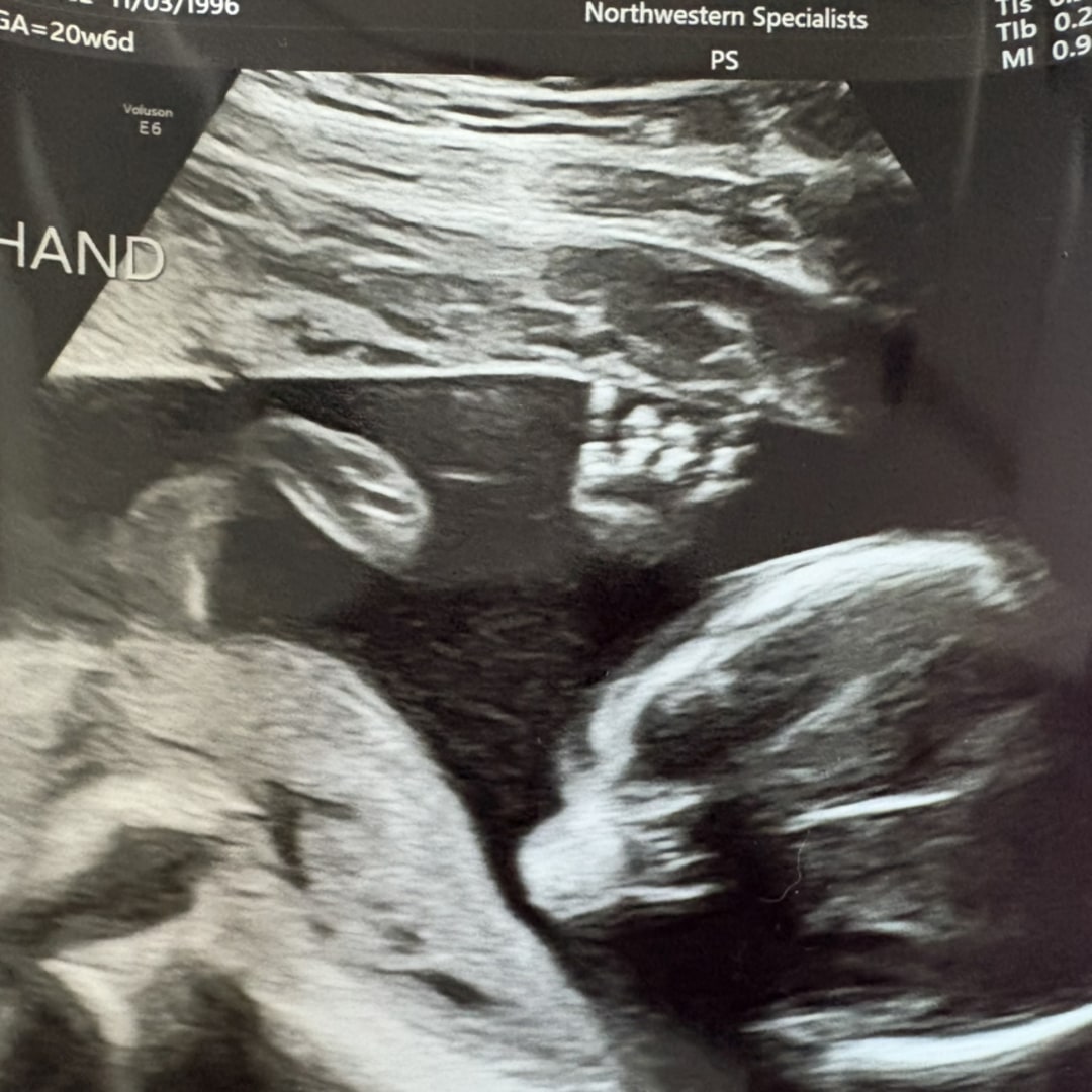Photo shared by Grace for their Babylist baby registry.