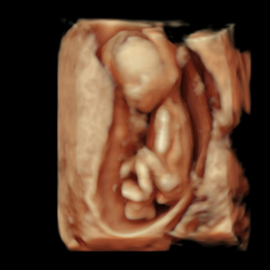 Photo shared by Iain for their Babylist baby registry.