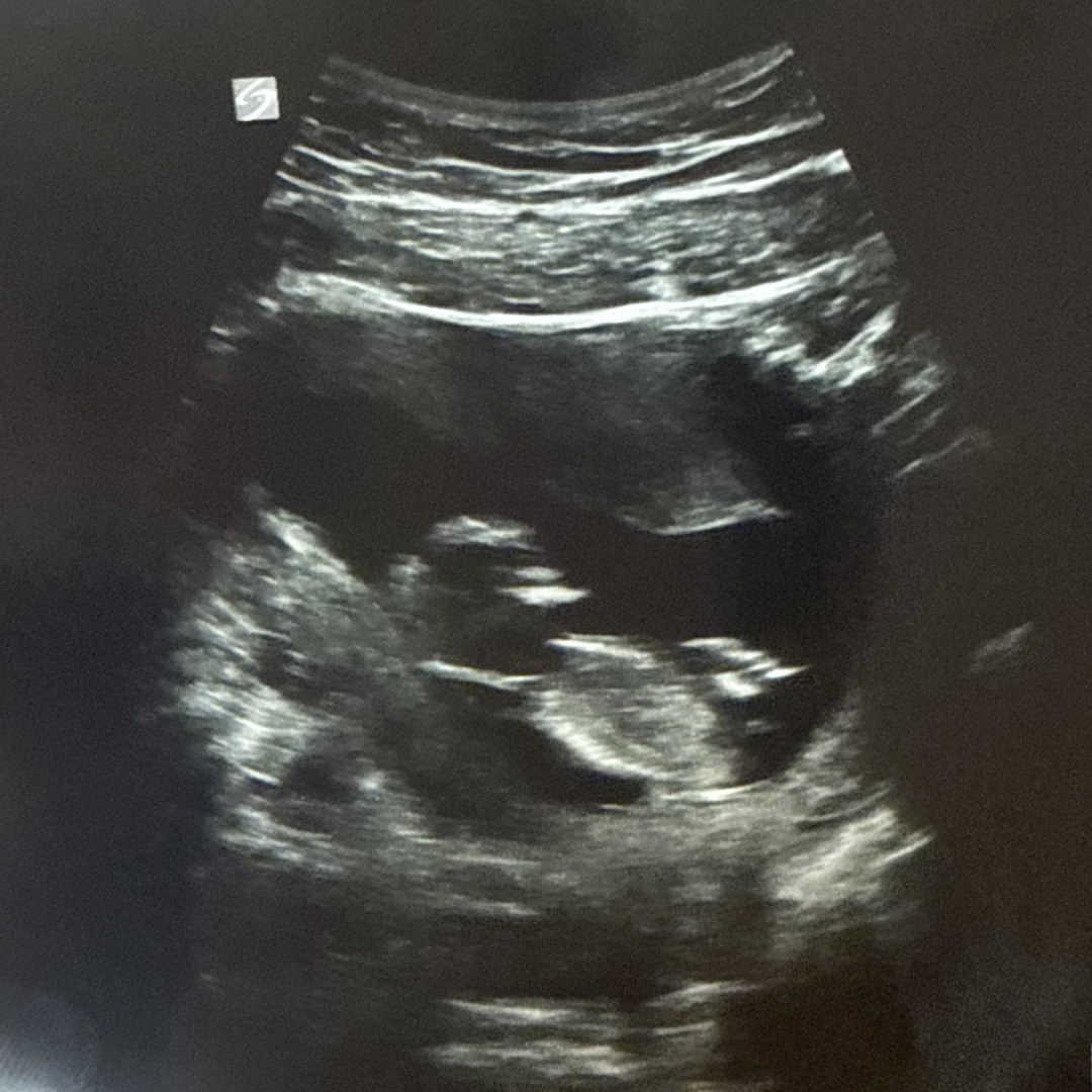 Photo shared by Alexa for their Babylist baby registry.