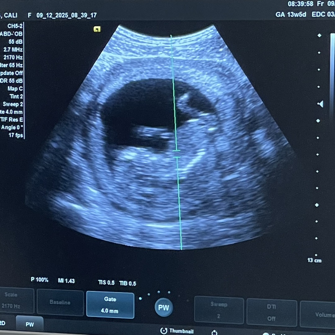 Photo shared by Cali for their Babylist baby registry.