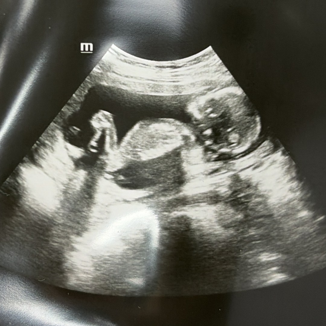 Photo shared by Marisol for their Babylist baby registry.