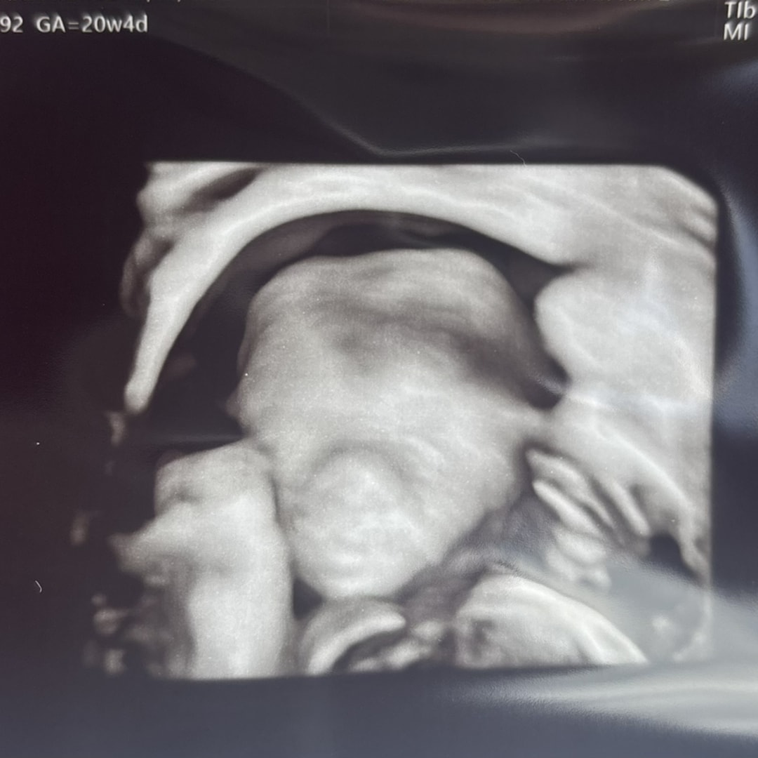 Photo shared by AnnMarie for their Babylist baby registry.