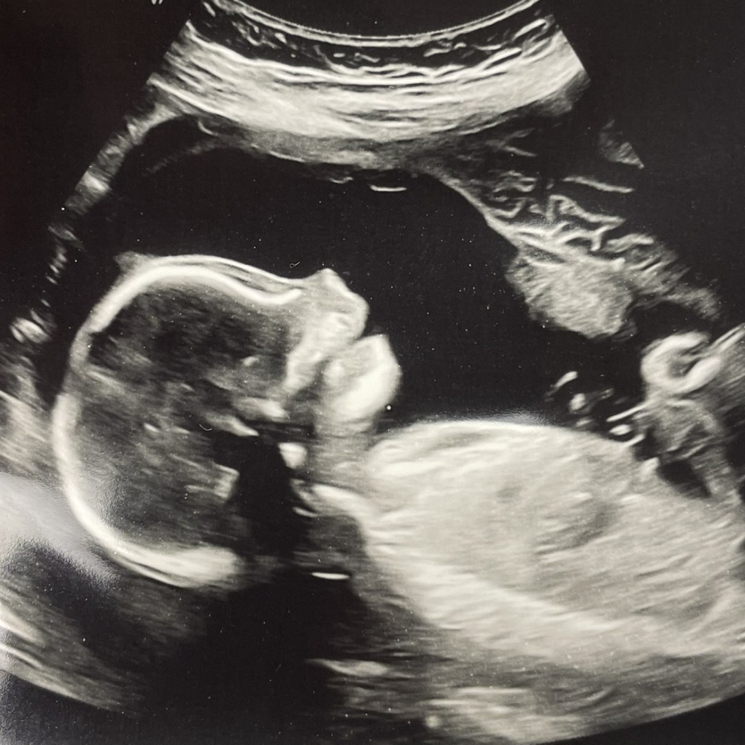 Photo shared by Alaina for their Babylist baby registry.
