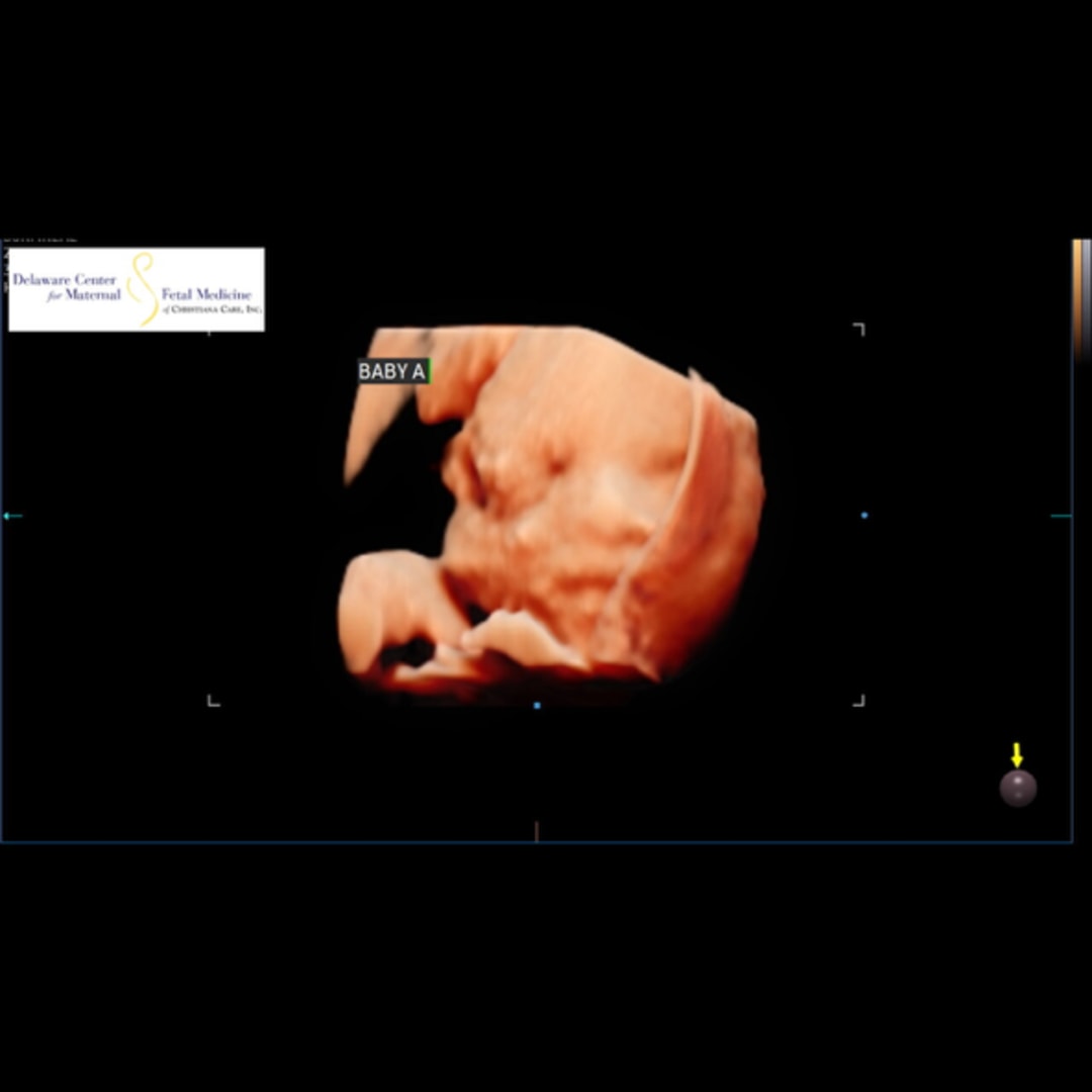 Photo shared by Jeanna for their Babylist baby registry.