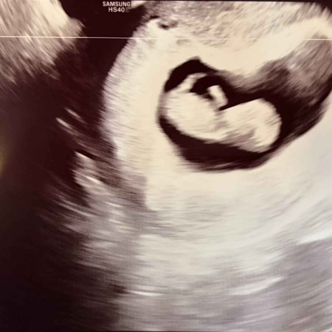 Photo shared by Casey for their Babylist baby registry.