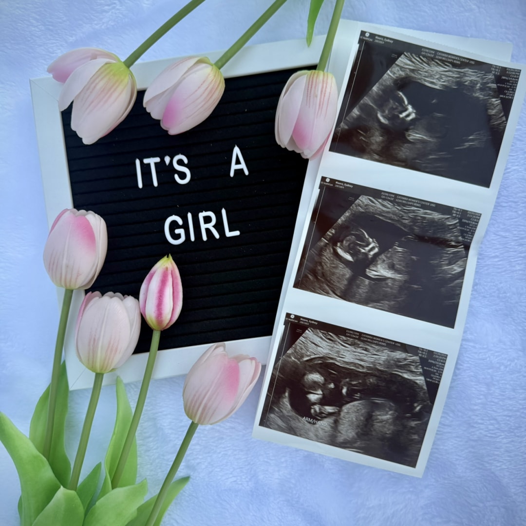 Photo shared by Sydney for their Babylist baby registry.