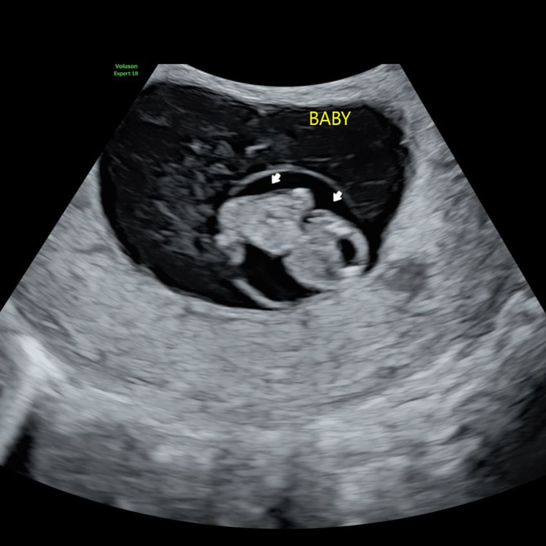 Photo shared by Aryanna for their Babylist baby registry.