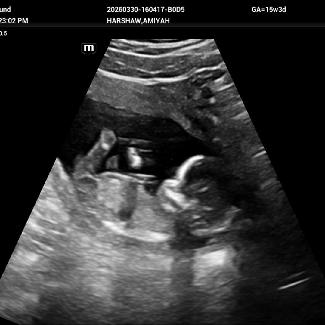 Photo shared by A’Miyah for their Babylist baby registry.